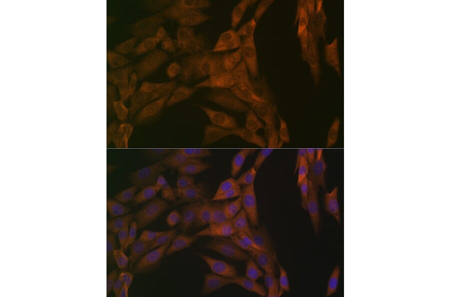 Immunofluorescence - Anti-PP2A-alpha + PPP2CB Antibody [ARC1889] (A309172) - Antibodies.com