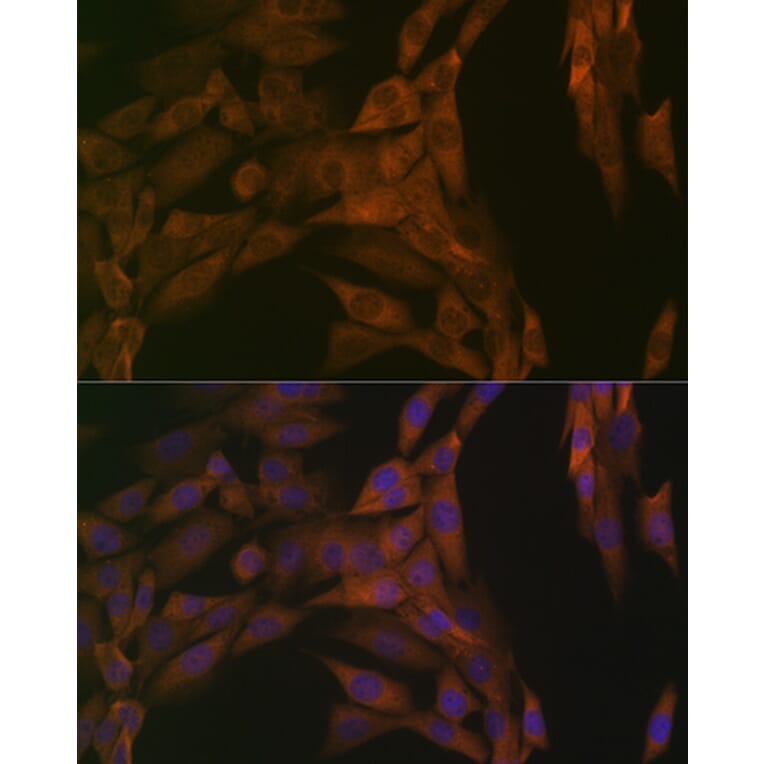Immunofluorescence - Anti-PP2A-alpha + PPP2CB Antibody [ARC1889] (A309172) - Antibodies.com