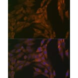 Immunofluorescence - Anti-PP2A-alpha + PPP2CB Antibody [ARC1889] (A309172) - Antibodies.com