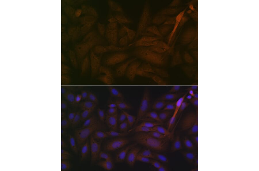 Immunofluorescence - Anti-PP2A-alpha + PPP2CB Antibody [ARC1889] (A309172) - Antibodies.com