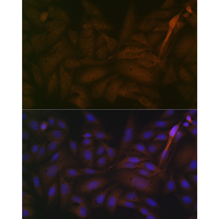Immunofluorescence - Anti-PP2A-alpha + PPP2CB Antibody [ARC1889] (A309172) - Antibodies.com