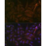 Immunofluorescence - Anti-PP2A-alpha + PPP2CB Antibody [ARC1889] (A309172) - Antibodies.com