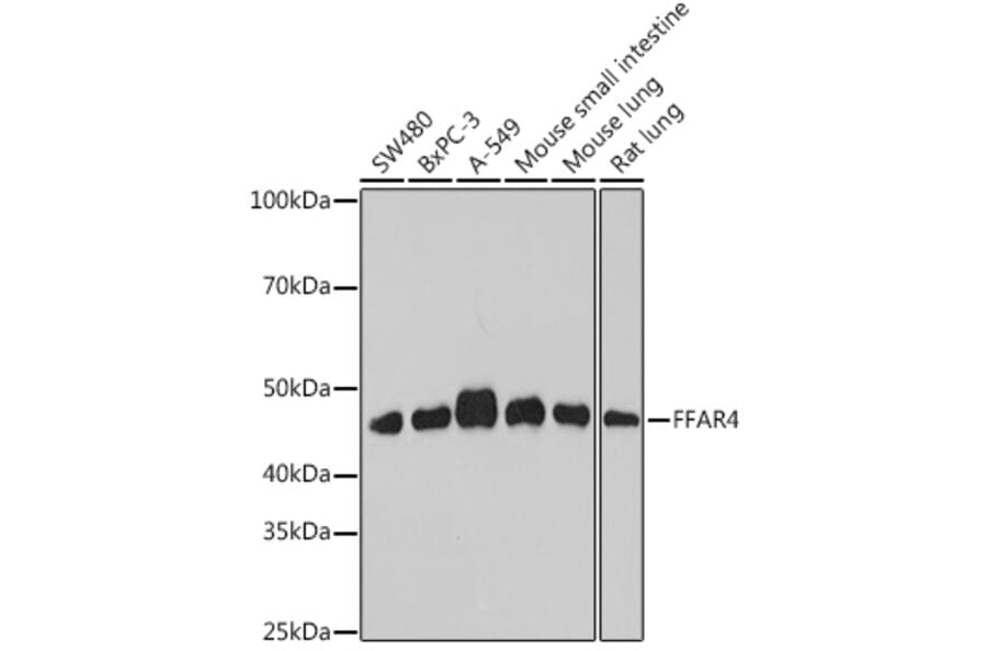 Western Blot - Anti-GPCR GPR120 Antibody (A309176) - Antibodies.com