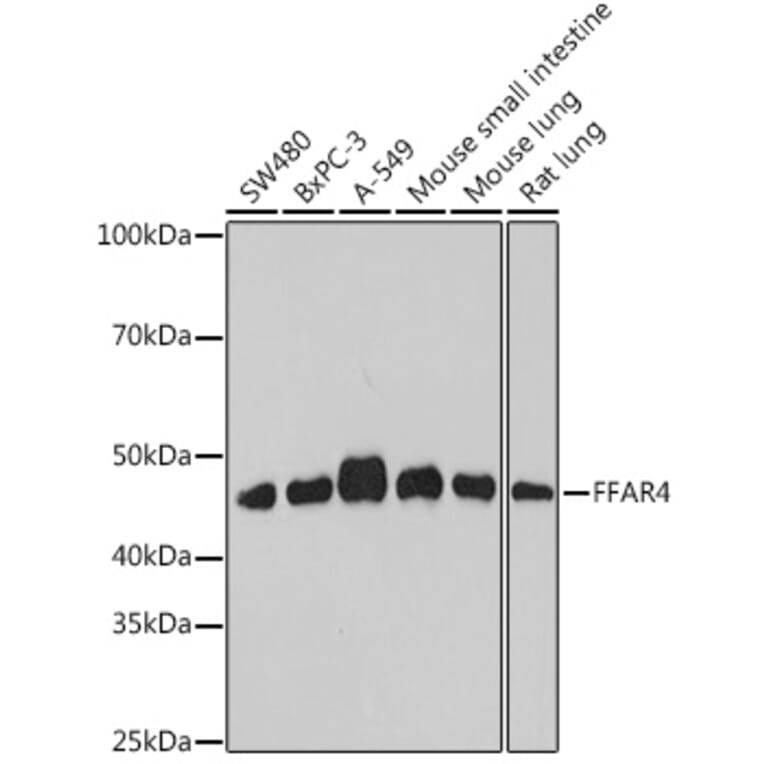 Western Blot - Anti-GPCR GPR120 Antibody (A309176) - Antibodies.com