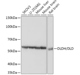 Western Blot - Anti-Lipoamide Dehydrogenase Antibody [ARC1224] (A309179) - Antibodies.com