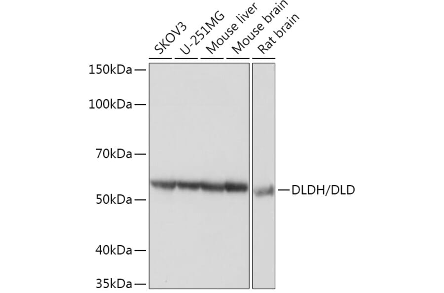 Western Blot - Anti-Lipoamide Dehydrogenase Antibody [ARC1224] (A309179) - Antibodies.com