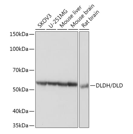 Western Blot - Anti-Lipoamide Dehydrogenase Antibody [ARC1224] (A309179) - Antibodies.com