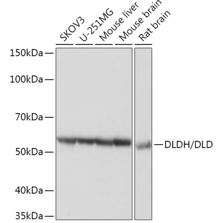 Western Blot - Anti-Lipoamide Dehydrogenase Antibody [ARC1224] (A309179) - Antibodies.com