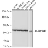 Western Blot - Anti-Lipoamide Dehydrogenase Antibody [ARC1224] (A309179) - Antibodies.com