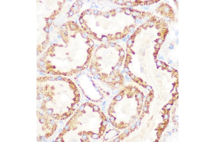 Immunohistochemistry - Anti-Lipoamide Dehydrogenase Antibody [ARC1224] (A309179) - Antibodies.com