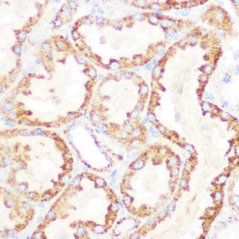 Immunohistochemistry - Anti-Lipoamide Dehydrogenase Antibody [ARC1224] (A309179) - Antibodies.com