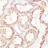 Immunohistochemistry - Anti-Lipoamide Dehydrogenase Antibody [ARC1224] (A309179) - Antibodies.com