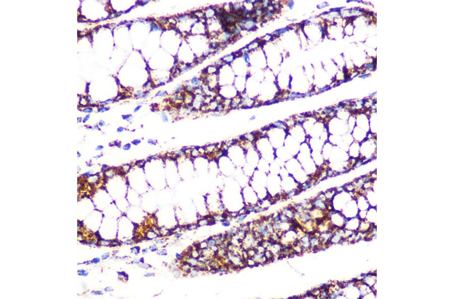 Immunohistochemistry - Anti-Lipoamide Dehydrogenase Antibody [ARC1224] (A309179) - Antibodies.com
