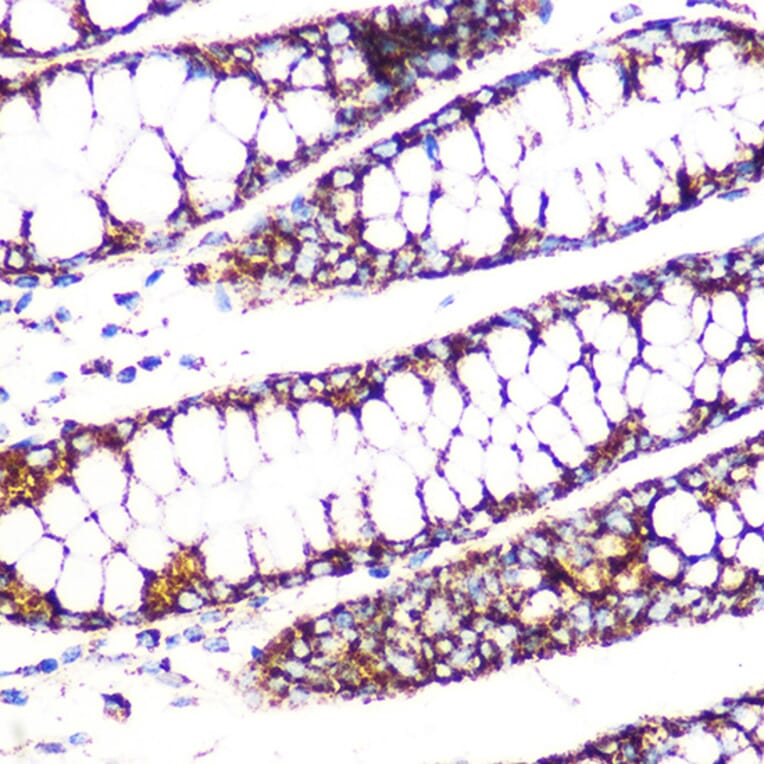 Immunohistochemistry - Anti-Lipoamide Dehydrogenase Antibody [ARC1224] (A309179) - Antibodies.com