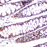 Immunohistochemistry - Anti-Lipoamide Dehydrogenase Antibody [ARC1224] (A309179) - Antibodies.com