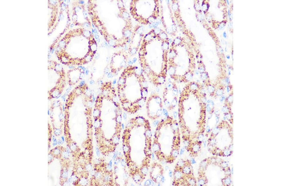 Immunohistochemistry - Anti-Lipoamide Dehydrogenase Antibody [ARC1224] (A309179) - Antibodies.com
