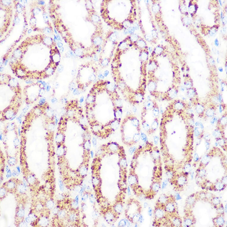 Immunohistochemistry - Anti-Lipoamide Dehydrogenase Antibody [ARC1224] (A309179) - Antibodies.com