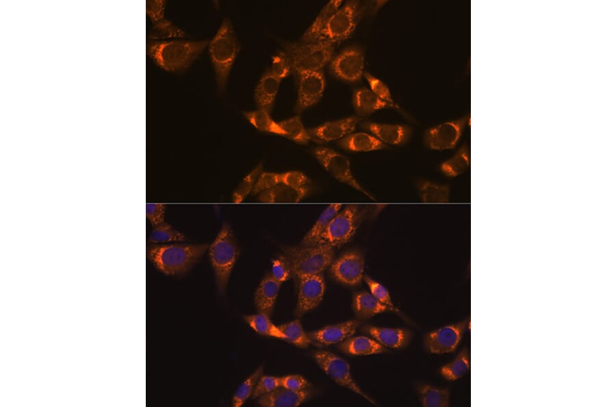 Immunofluorescence - Anti-Lipoamide Dehydrogenase Antibody [ARC1224] (A309179) - Antibodies.com