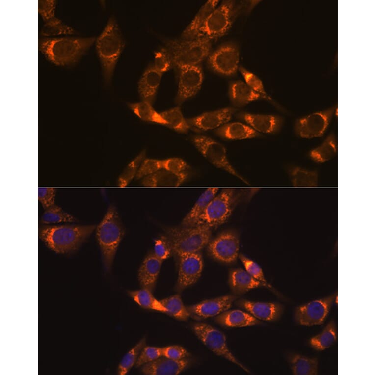 Immunofluorescence - Anti-Lipoamide Dehydrogenase Antibody [ARC1224] (A309179) - Antibodies.com