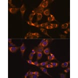 Immunofluorescence - Anti-Lipoamide Dehydrogenase Antibody [ARC1224] (A309179) - Antibodies.com