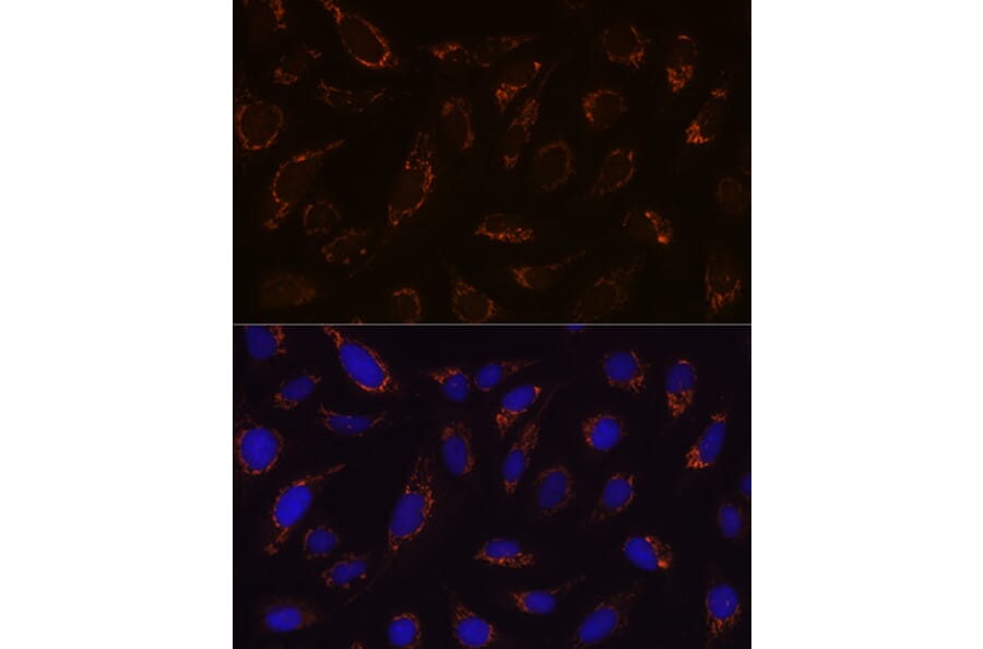 Immunofluorescence - Anti-Lipoamide Dehydrogenase Antibody [ARC1224] (A309179) - Antibodies.com