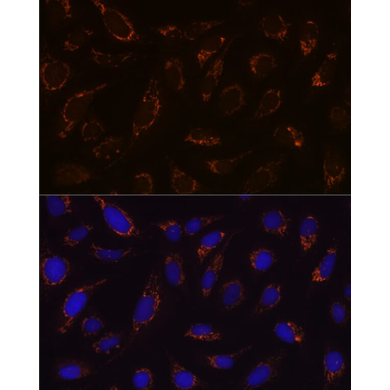 Immunofluorescence - Anti-Lipoamide Dehydrogenase Antibody [ARC1224] (A309179) - Antibodies.com