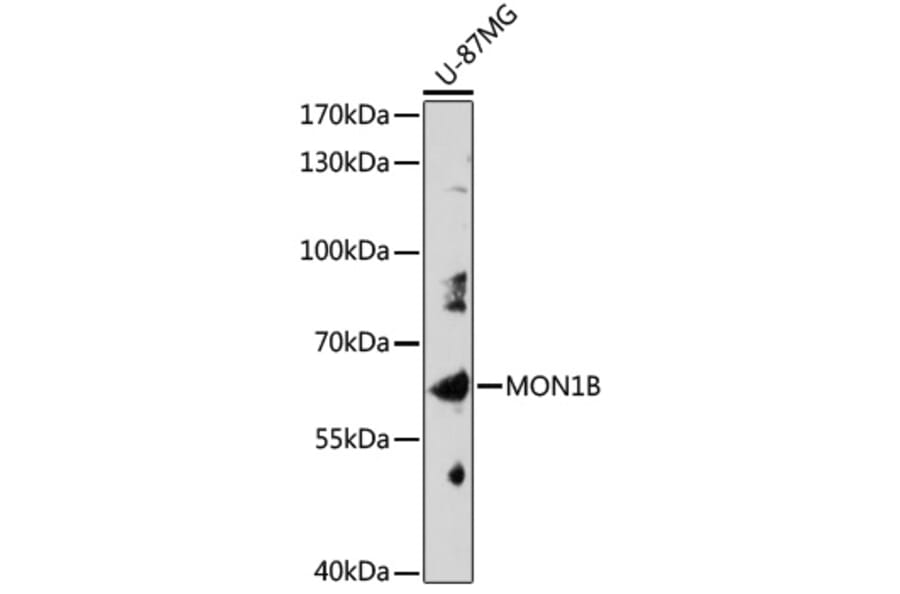 Western Blot - Anti-MON1B Antibody (A309180) - Antibodies.com