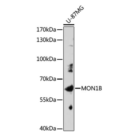Western Blot - Anti-MON1B Antibody (A309180) - Antibodies.com
