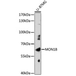 Western Blot - Anti-MON1B Antibody (A309180) - Antibodies.com