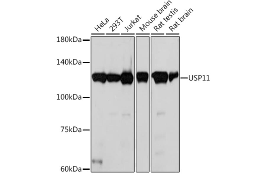 Western Blot - Anti-USP11 Antibody [ARC2176] (A309181) - Antibodies.com