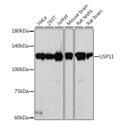 Western Blot - Anti-USP11 Antibody [ARC2176] (A309181) - Antibodies.com