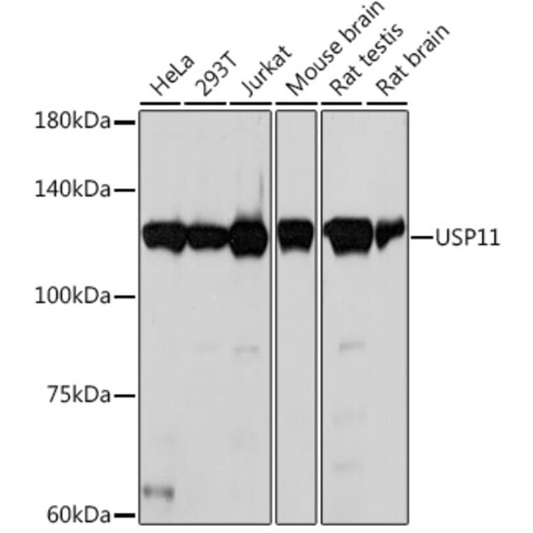 Western Blot - Anti-USP11 Antibody [ARC2176] (A309181) - Antibodies.com