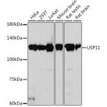 Western Blot - Anti-USP11 Antibody [ARC2176] (A309181) - Antibodies.com