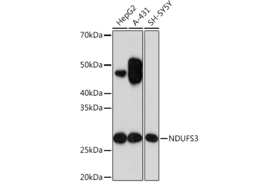 Western Blot - Anti-NDUFS3 Antibody [ARC1049] (A309182) - Antibodies.com
