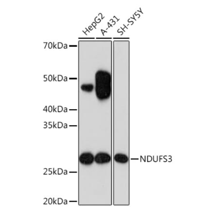 Western Blot - Anti-NDUFS3 Antibody [ARC1049] (A309182) - Antibodies.com