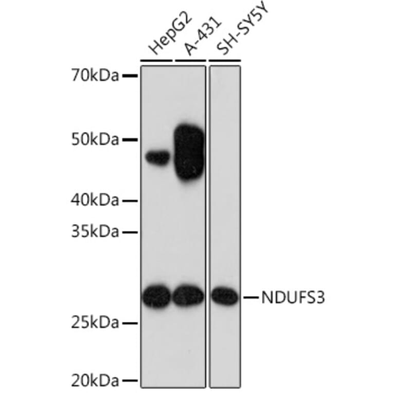 Western Blot - Anti-NDUFS3 Antibody [ARC1049] (A309182) - Antibodies.com
