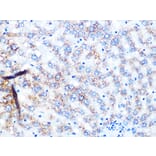 Immunohistochemistry - Anti-NDUFS3 Antibody [ARC1049] (A309182) - Antibodies.com