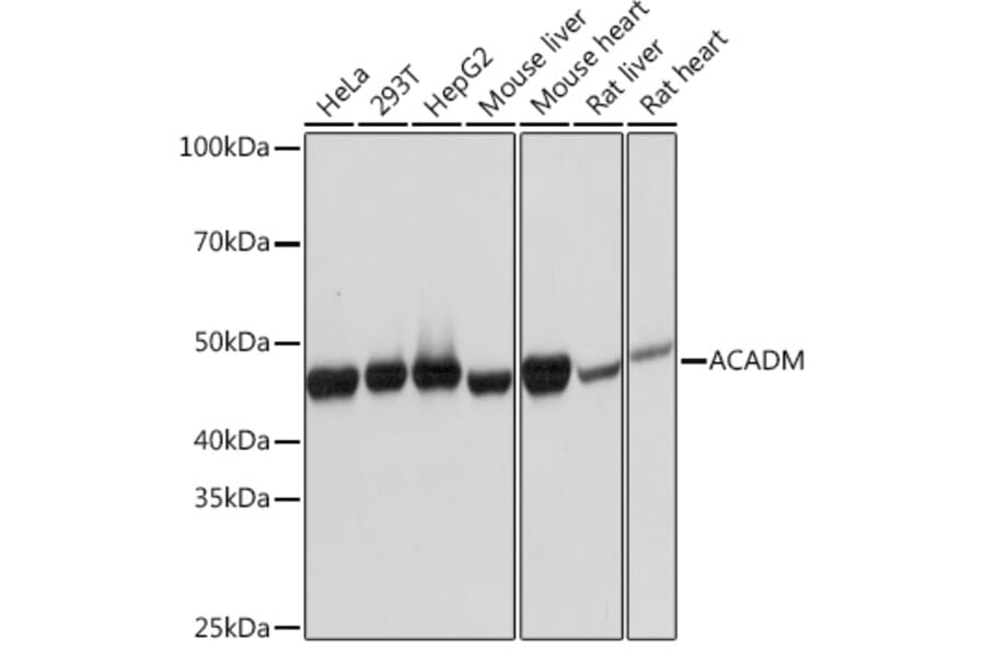 Western Blot - Anti-ACADM/MCAD Antibody [ARC1035] (A309183) - Antibodies.com