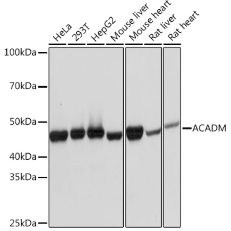 Western Blot - Anti-ACADM/MCAD Antibody [ARC1035] (A309183) - Antibodies.com