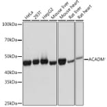 Western Blot - Anti-ACADM/MCAD Antibody [ARC1035] (A309183) - Antibodies.com