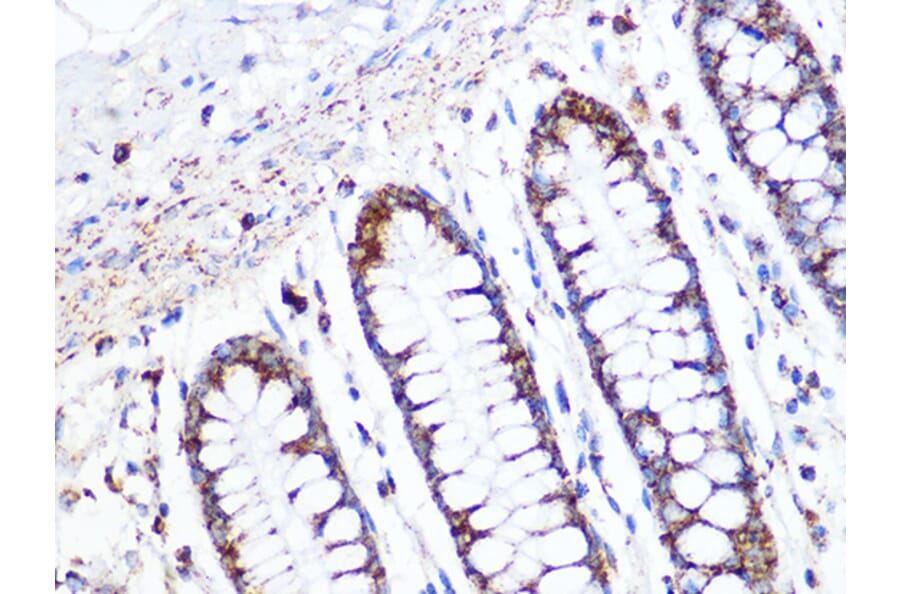 Immunohistochemistry - Anti-ACADM/MCAD Antibody [ARC1035] (A309183) - Antibodies.com