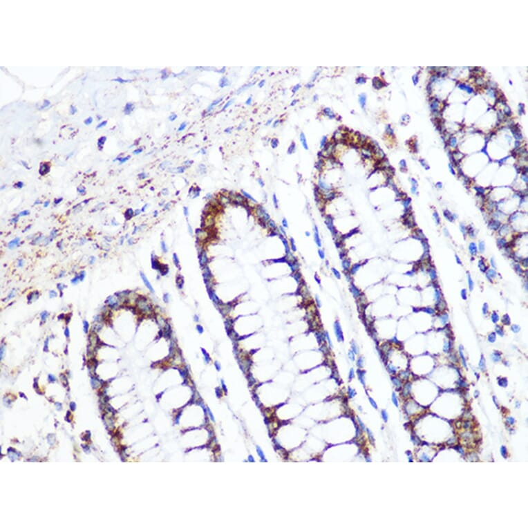 Immunohistochemistry - Anti-ACADM/MCAD Antibody [ARC1035] (A309183) - Antibodies.com