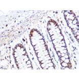 Immunohistochemistry - Anti-ACADM/MCAD Antibody [ARC1035] (A309183) - Antibodies.com