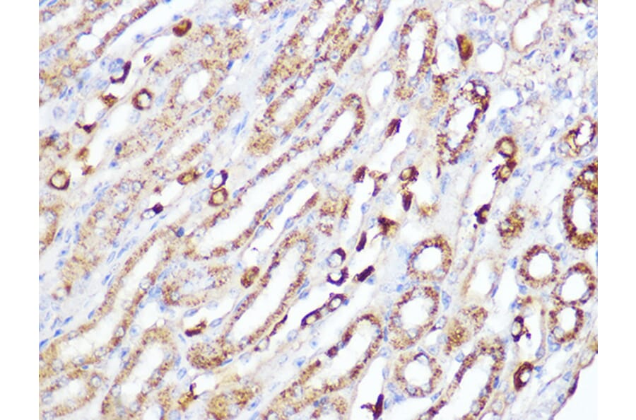 Immunohistochemistry - Anti-ACADM/MCAD Antibody [ARC1035] (A309183) - Antibodies.com