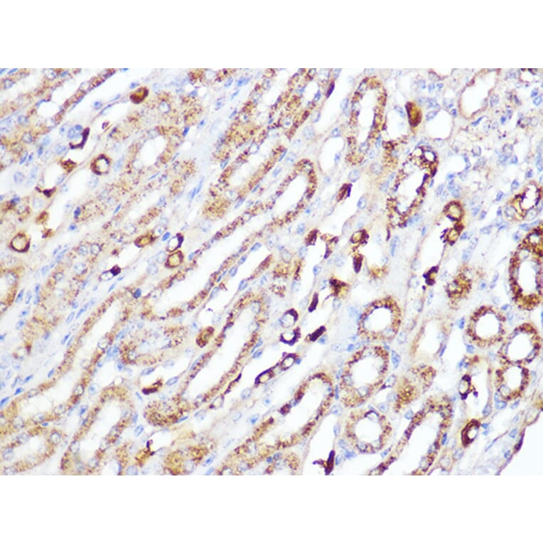Immunohistochemistry - Anti-ACADM/MCAD Antibody [ARC1035] (A309183) - Antibodies.com
