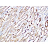 Immunohistochemistry - Anti-ACADM/MCAD Antibody [ARC1035] (A309183) - Antibodies.com