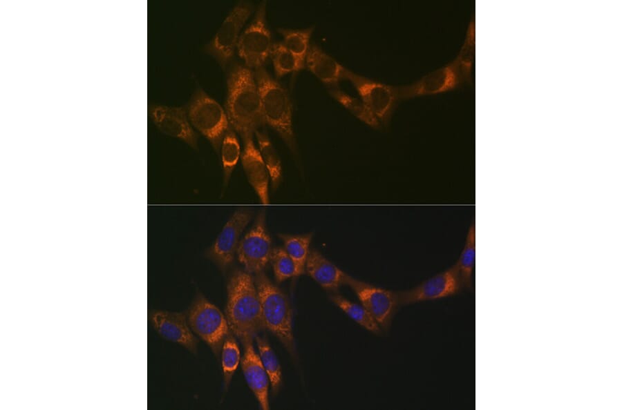 Immunofluorescence - Anti-ACADM/MCAD Antibody [ARC1035] (A309183) - Antibodies.com