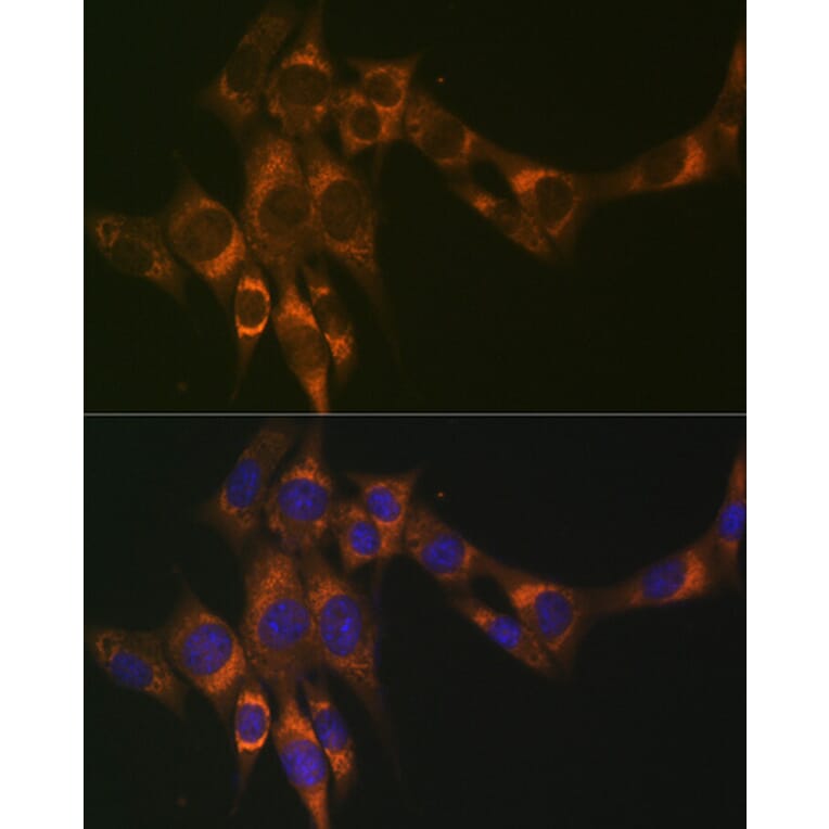 Immunofluorescence - Anti-ACADM/MCAD Antibody [ARC1035] (A309183) - Antibodies.com