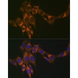 Immunofluorescence - Anti-ACADM/MCAD Antibody [ARC1035] (A309183) - Antibodies.com