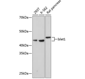 Western Blot - Anti-Islet 1 Antibody [ARC0511] (A309185) - Antibodies.com